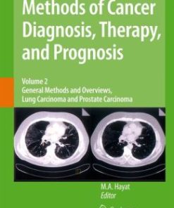 Methods of Cancer Diagnosis, Therapy and Prognosis: General Methods and Overviews, Lung Carcinoma and Prostate Carcinoma (PDF)