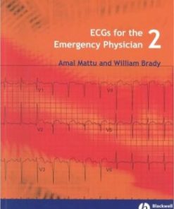 ECGs for the Emergency Physician 2