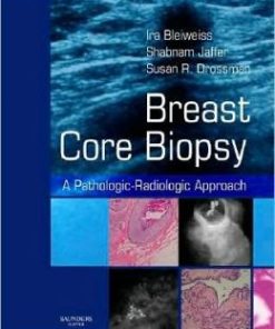 Breast Core Biopsy: A Pathologic-Radiologic Approach