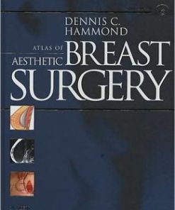 Atlas of Aesthetic Breast Surgery