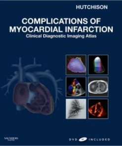 Complications of Myocardial Infarction: Clinical Diagnostic Imaging Atlas (PDF)