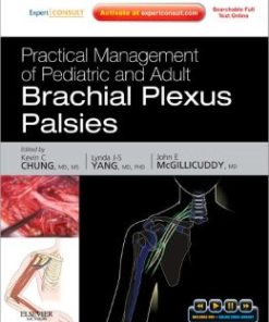 Practical Management of Pediatric and Adult Brachial Plexus Palsies