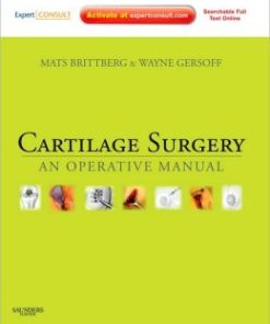 Cartilage Surgery: An Operative Manual