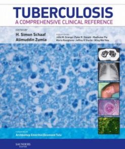 Tuberculosis: A Comprehensive Clinical Reference (PDF)