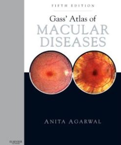 Gass’ Atlas of Macular Diseases: 2-Volume Set, 5th Edition