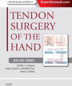 Tendon Surgery of the Hand