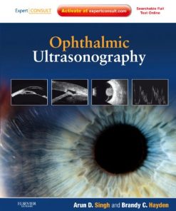 Ophthalmic Ultrasonography (Videos Only, Well Organized)