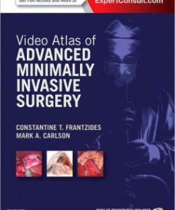 Video Atlas of Advanced Minimally Invasive Surgery (PDF)