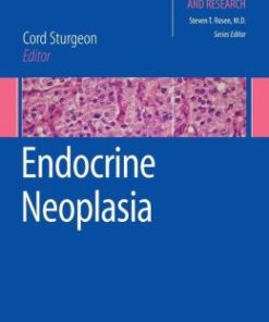 Endocrine Neoplasia (EPUB)