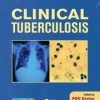 Clinical Tuberculosis, Fifth Edition