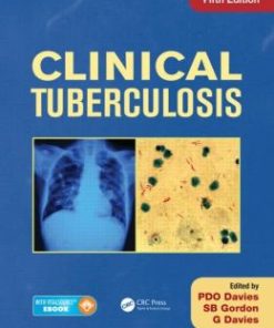 Clinical Tuberculosis, Fifth Edition