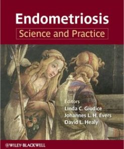 Endometriosis: Science and Practice