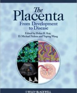 The Placenta: From Development to Disease