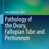 Pathology of the Ovary, Fallopian Tube and Peritoneum (EPUB)