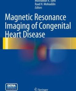 Magnetic Resonance Imaging of Congenital Heart Disease (PDF)