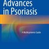 Advances in Psoriasis: A Multisystemic Guide (EPUB)