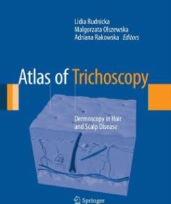 Atlas of Trichoscopy: Dermoscopy in Hair and Scalp Disease (EPUB)