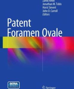 Patent Foramen Ovale (EPUB)