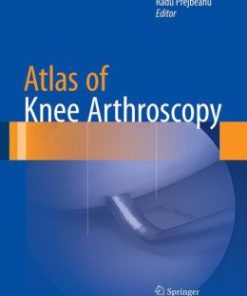 Atlas of Knee Arthroscopy (EPUB)