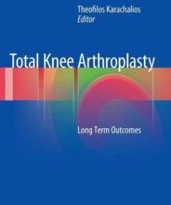 Total Knee Arthroplasty: Long Term Outcomes