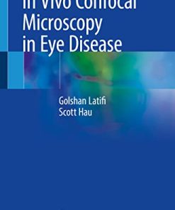 In Vivo Confocal Microscopy in Eye Disease (PDF)