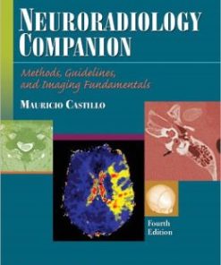 Neuroradiology Companion: Methods, Guidelines, and Imaging Fundamentals (EPUB)