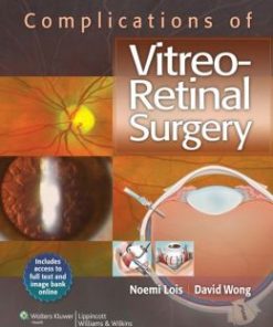 Complications of Vitreo-Retinal Surgery (PDF)