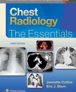 Chest Radiology: The Essentials, 3rd Edition (EPUB)