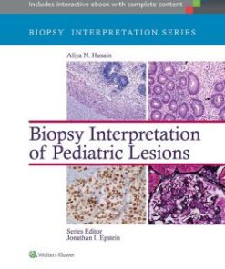 Biopsy Interpretation of Pediatric Lesions (EPUB)