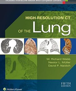 High-Resolution CT of the Lung (EPUB)