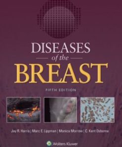 Diseases of the Breast 5e (PDF)