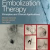 Embolization Therapy: Principles and Clinical Applications (EPUB)