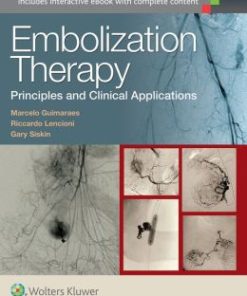 Embolization Therapy: Principles and Clinical Applications (EPUB)