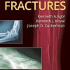 Handbook of Fractures, 5th Edition (EPUB)