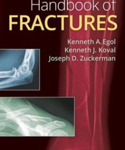 Handbook of Fractures, 5th Edition (EPUB)