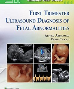 First Trimester Ultrasound Diagnosis of Fetal Abnormalities (EPUB)