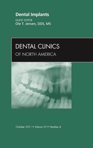 Dental Implants, An Issue of Dental Clinics (Volume 55-4) (The Clinics: Dentistry (Volume 55-4)) (PDF) Dental Implants, An Issue of Dental Clinics (Volume 55-4) (The Clinics: Dentistry (Volume 55-4)) (PDF)