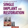 Principles and Practice of Single Implant and Restorations