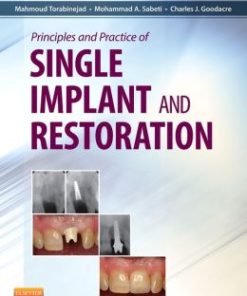 Principles and Practice of Single Implant and Restorations