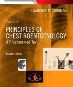 Felson’s Principles of Chest Roentgenology, A Programmed Text, 4th Edition (PDF)