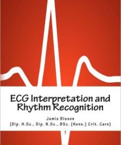 ECG Interpretation and Rhythm Recognition (EPUB)