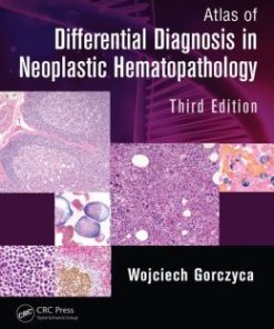 Atlas of Differential Diagnosis in Neoplastic Hematopathology, Third Edition