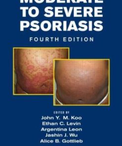 Moderate to Severe Psoriasis, Fourth Edition