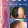 Hair Loss and Restoration, 2nd Edition