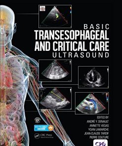 Basic Transesophageal and Critical Care Ultrasound (PDF)