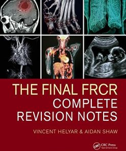 The Final FRCR: Complete Revision Notes (PDF)