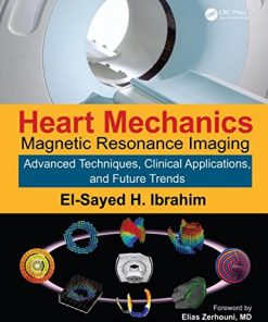 Heart Mechanics: Magnetic Resonance Imaging―Advanced Techniques, Clinical Applications, and Future Trends (Volume 2) (EPUB)