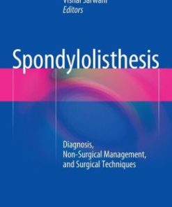 Spondylolisthesis: Diagnosis, Non-Surgical Management, and Surgical Techniques (PDF)