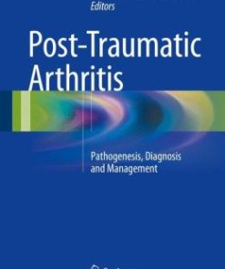 Post-Traumatic Arthritis: Pathogenesis, Diagnosis and Management (EPUB)