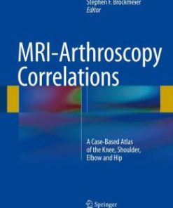 MRI-Arthroscopy Correlations: A Case-Based Atlas of the Knee, Shoulder, Elbow and Hip (PDF)